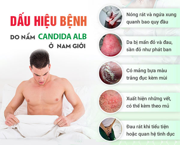 Tổng Quan Nấm Sinh Dục Nam