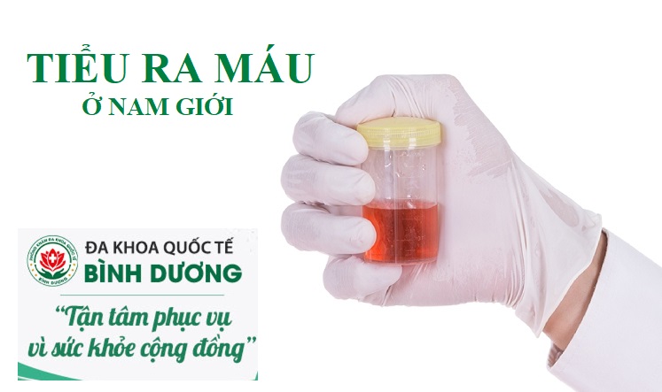Đi Tiểu Ra Máu, Nguyên Nhân, Dấu Hiệu Và Cách Chữa Trị Hiệu Quả