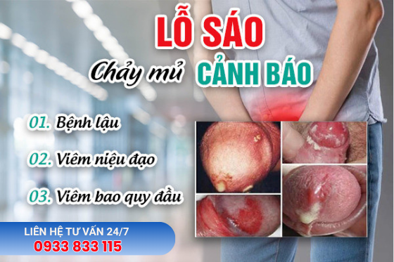 benh-xa-hoi (39).png